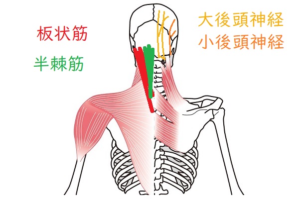 頭痛の説明