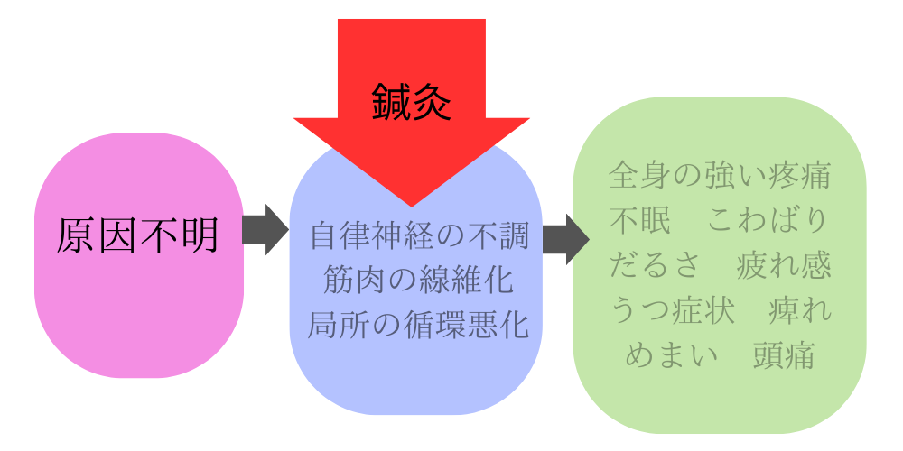 難病 線維筋痛症2枚目