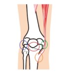 膝痛の痛む位置