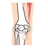 鍼灸施術例 右膝内側側副靭帯損傷 北京堂鍼灸院 新潟市西区 整形外科疾患専門