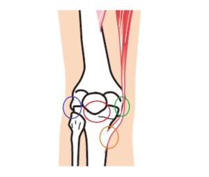 膝痛の痛む位置