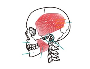 側頭部の刺鍼ポイント