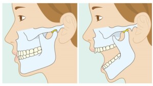 顎関節の構造図