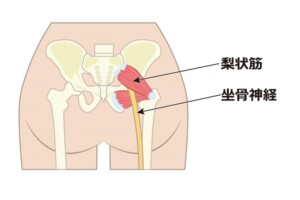 坐骨神経と梨状筋