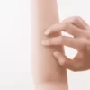 腕の障害